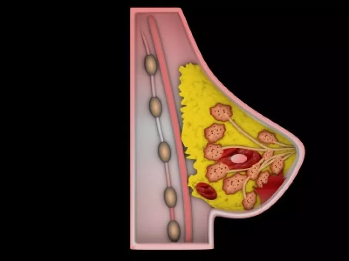 Súlyon, mellszöveten és származáson múlik, kockázatos-e a hormonpótlás